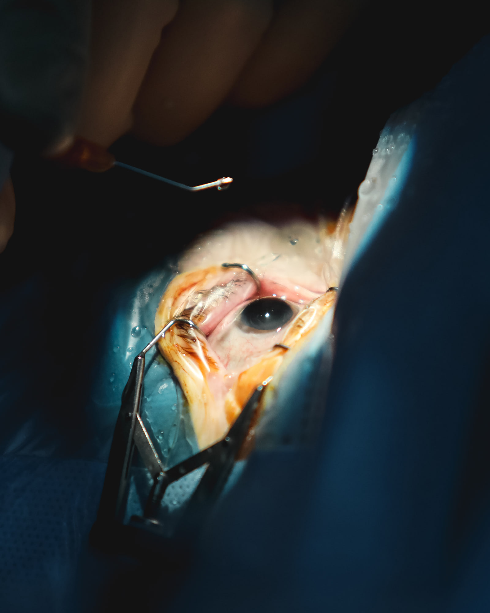 Contexto clínico do tratamento de uveíte na Oftalmologia Algarve